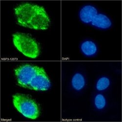 SR-BI Rabbit anti-Human, Clone: 185-1G2 (B467), Novus Biologicals:Antibodies:Primary